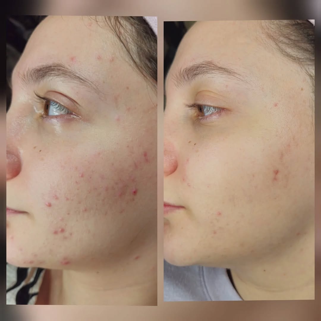 Post 6 by Korean beauty in dubai✨️ on Instagram (carousel)