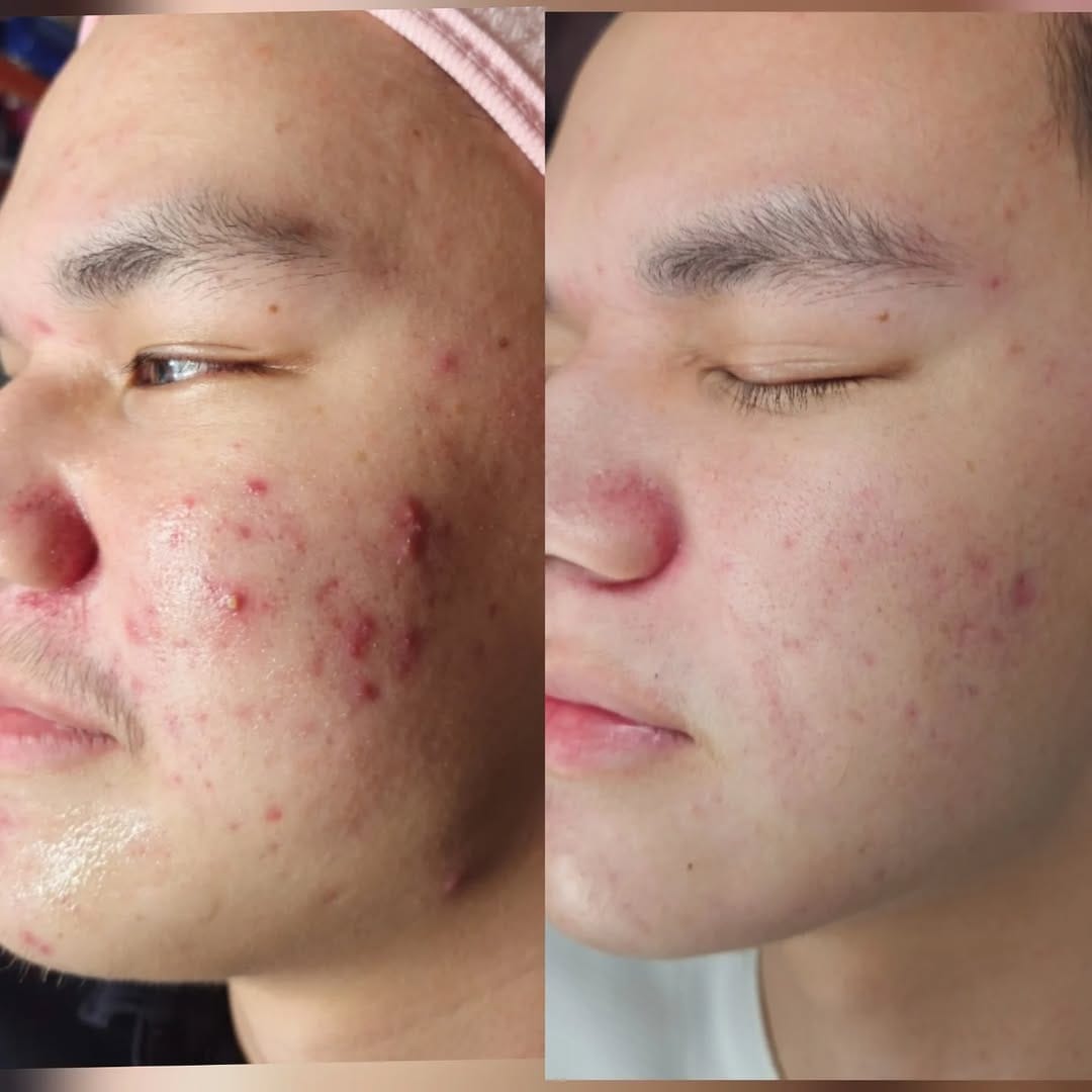 Post 7 by Korean beauty in dubai✨️ on Instagram (carousel)