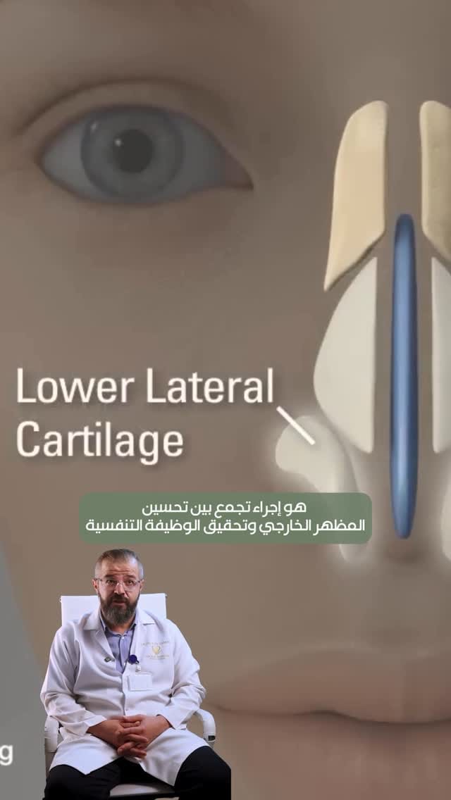 Post 6 by Dr.Hala Hisham on Instagram (video)