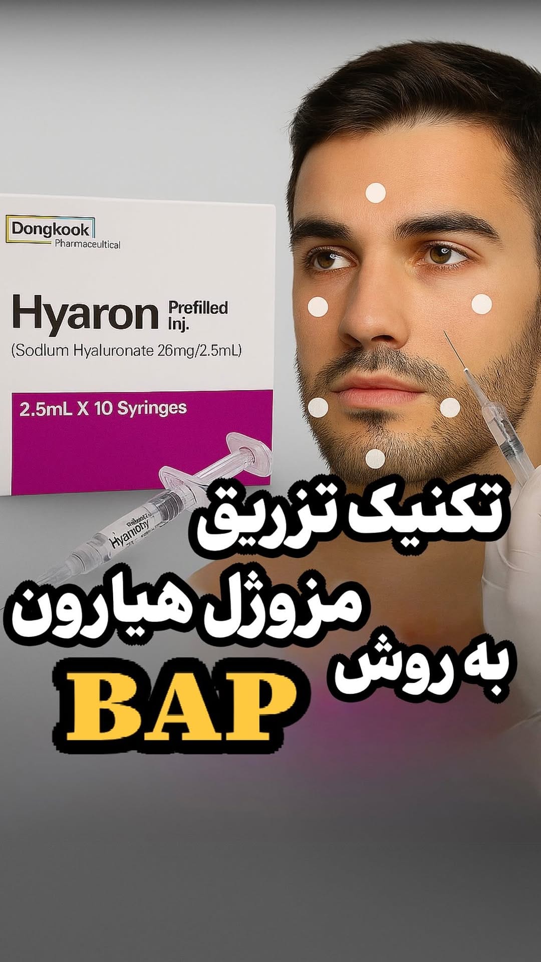 Post 10 by 🔴آموزش بوتاکس،فیلر،فیلر بادی،پیرسینگ،مزوتراپی،میکرونیدلینگ🔴 on Instagram (video)
