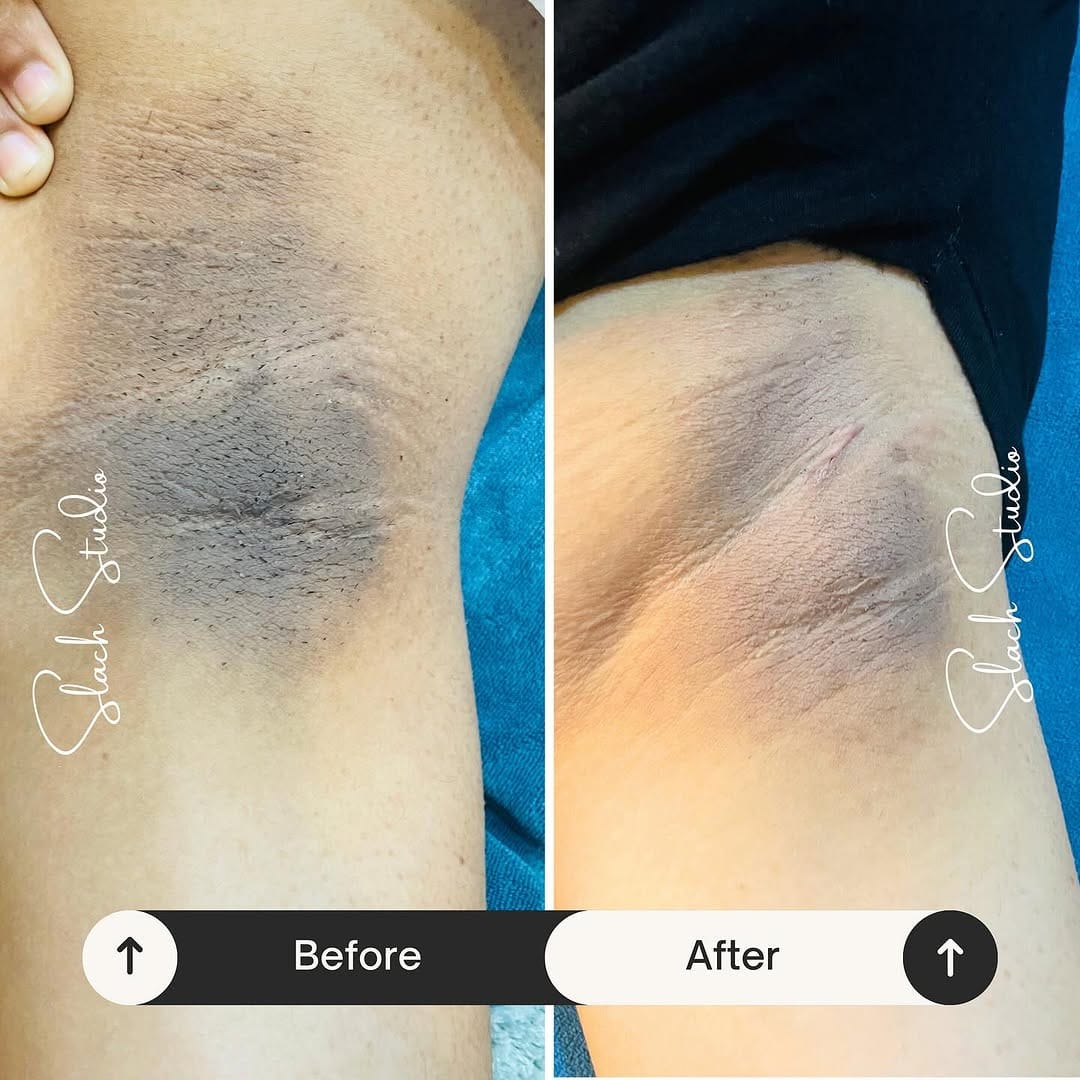 Post 5 by Nainpreet Slach | Cosmetologist on Instagram (image)