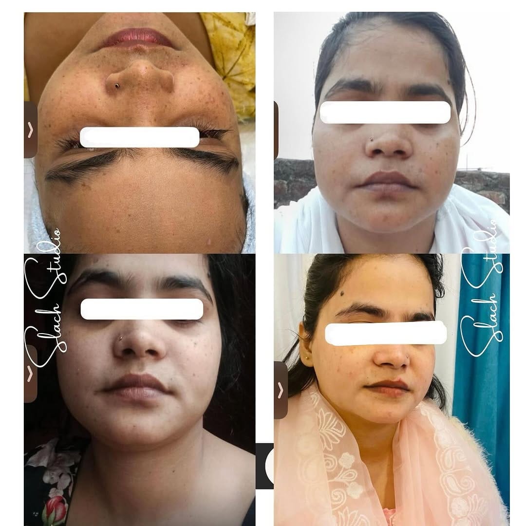 Post 4 by Nainpreet Slach | Cosmetologist on Instagram (image)