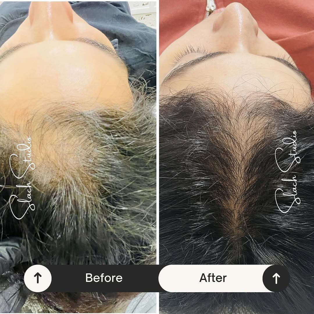 Post 7 by Nainpreet Slach | Cosmetologist on Instagram (image)