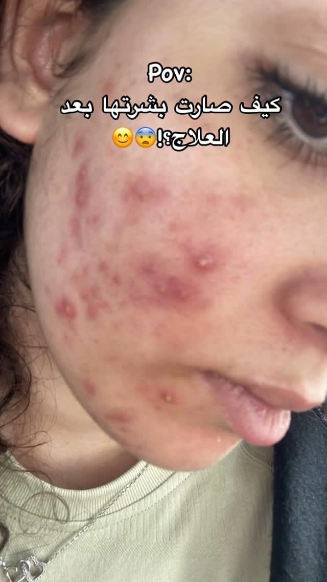 Post 9 by Younis.center on Instagram (video)