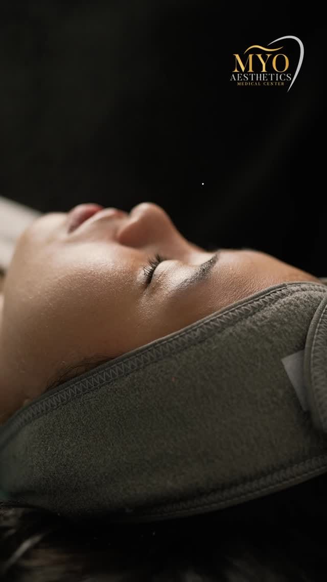 Post 10 by Myo Aesthetics on Instagram (video)