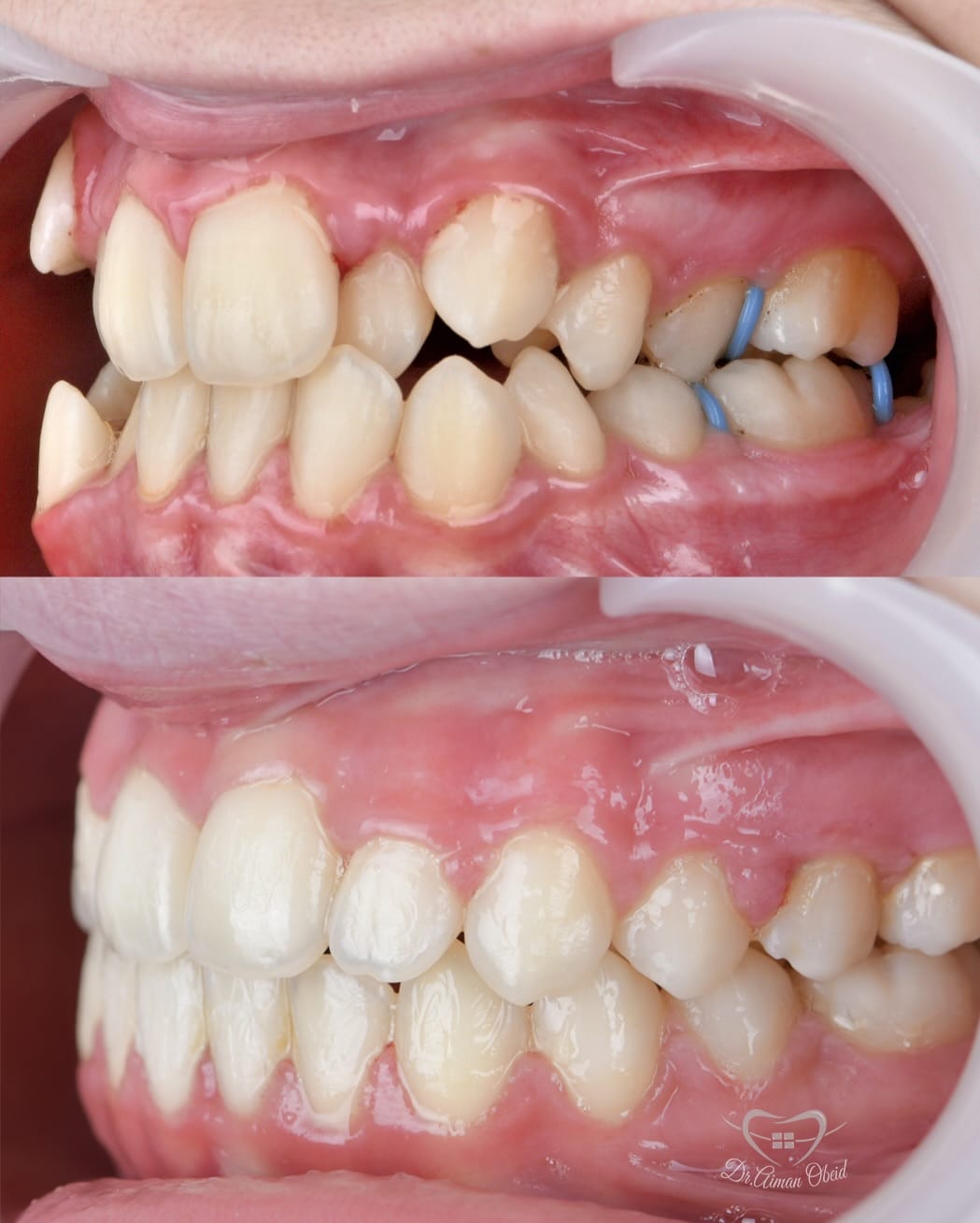 Post 5 by Braces_orthodontist on Instagram (carousel)