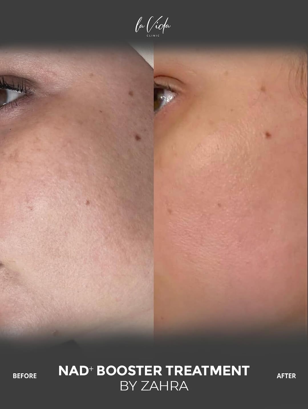 Post 4 by ZAHRA AESTHETICIAN on Instagram (image)