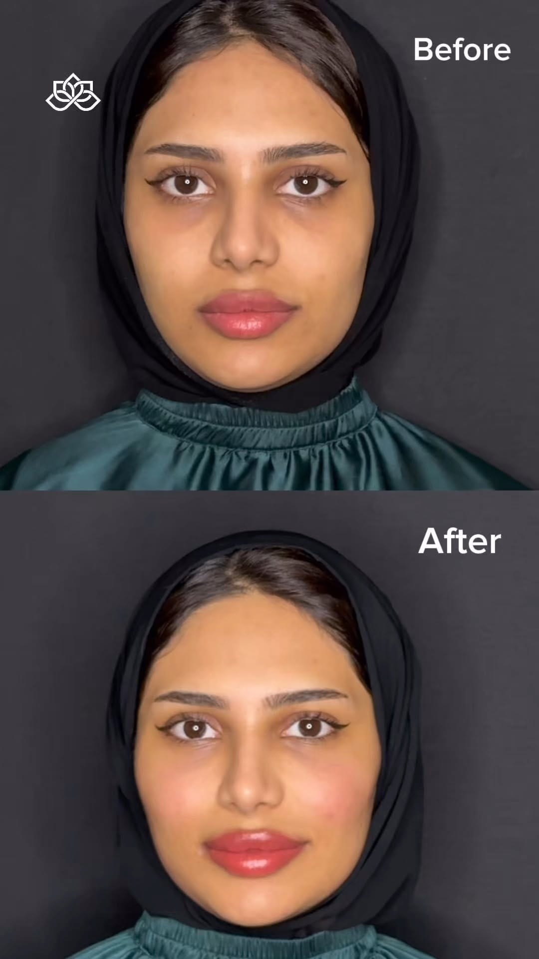 Post 2 by Oriana Aesthetic Clinic - Pullman Hotel Sharjah on Instagram (video)