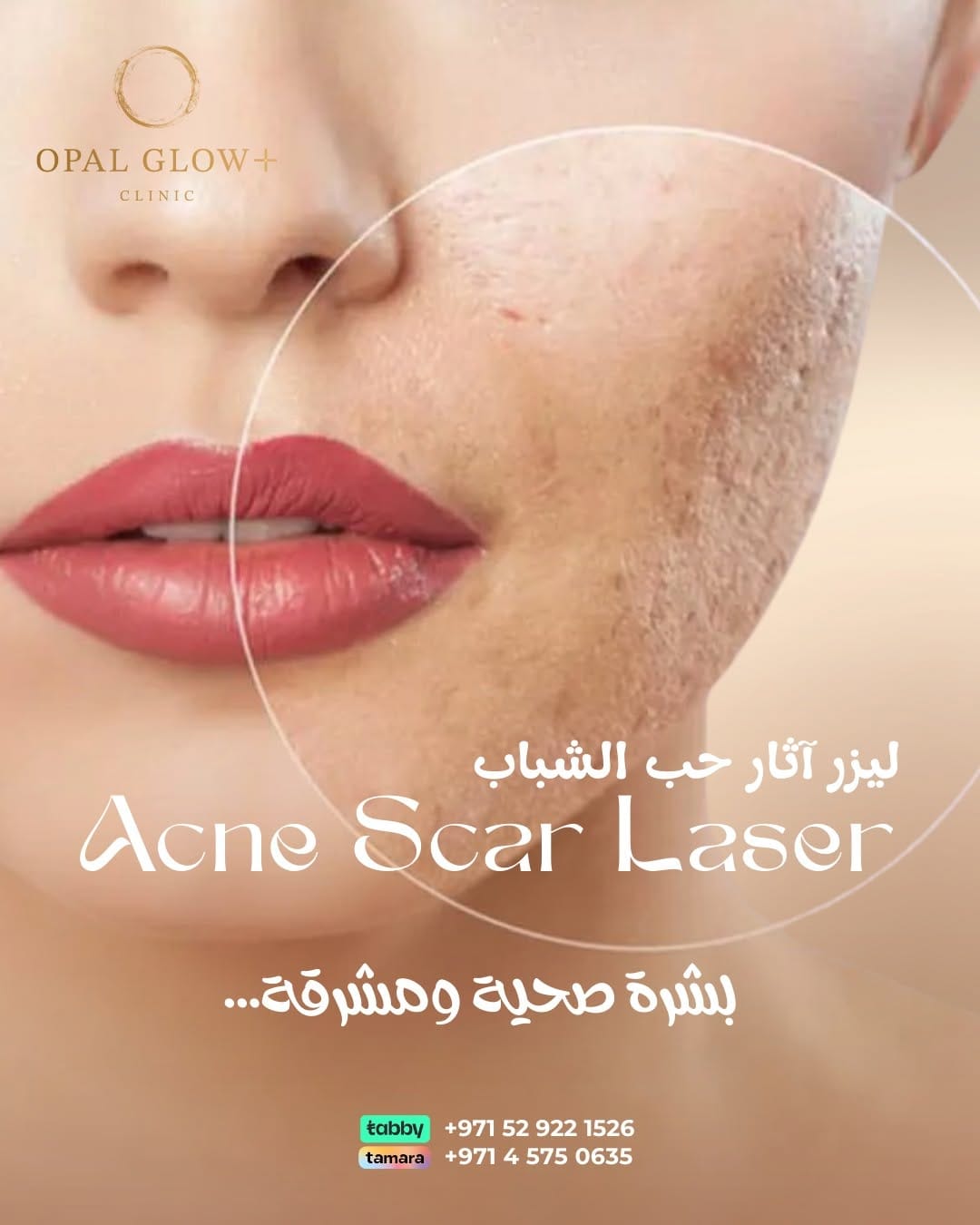 Post 1 by OPAL GLOW PLUS on Instagram (image)