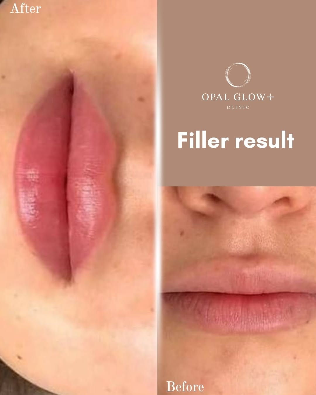 Post 3 by OPAL GLOW PLUS on Instagram (image)