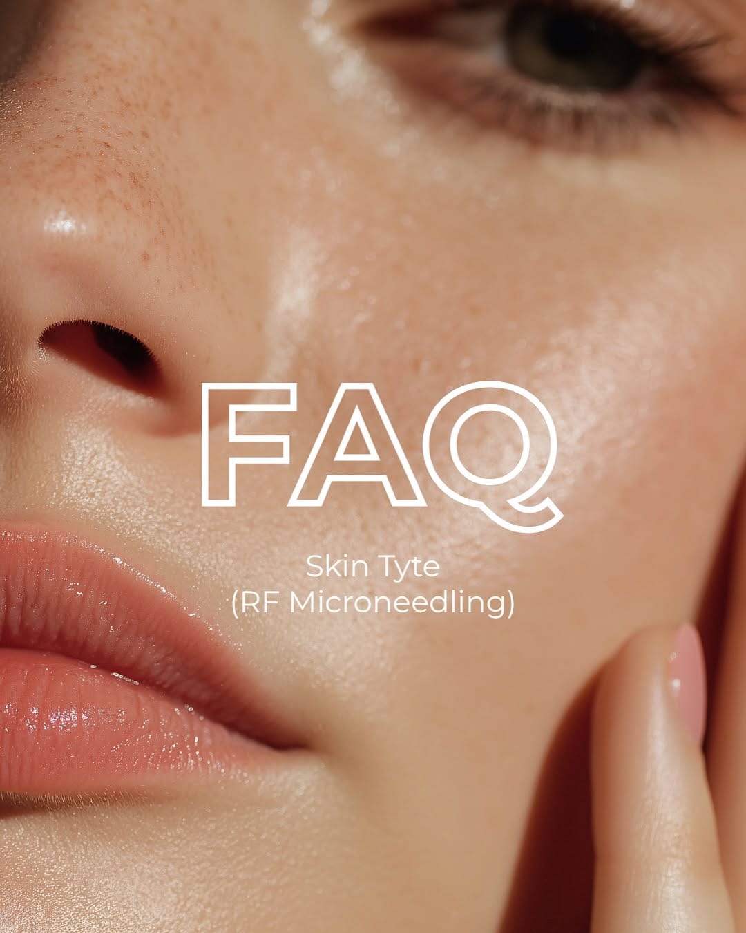 Post 10 by Facette Facial Bar on Instagram (carousel)