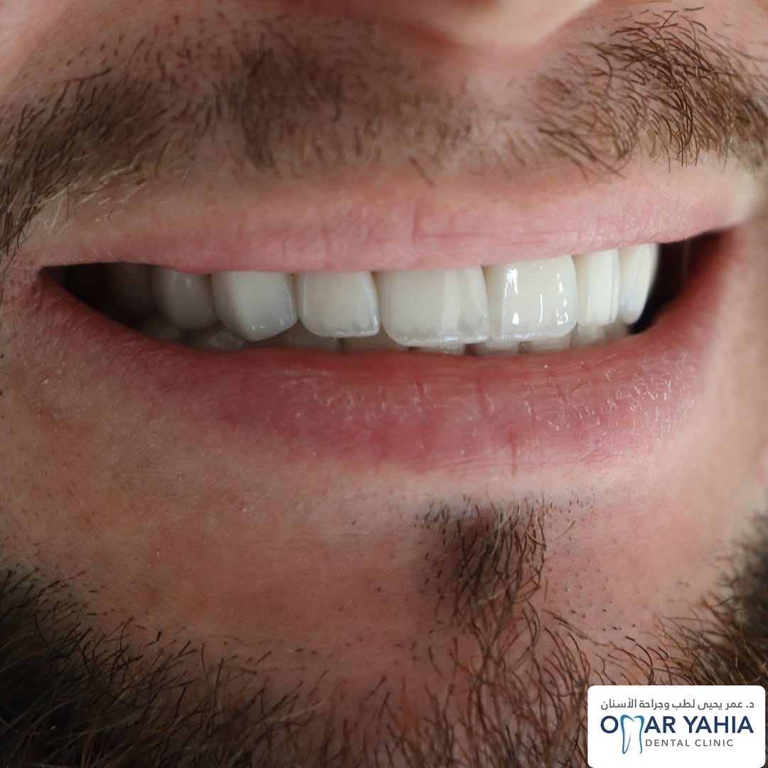 Post 7 by Omar Yahia Dental Clinic on Instagram (image)
