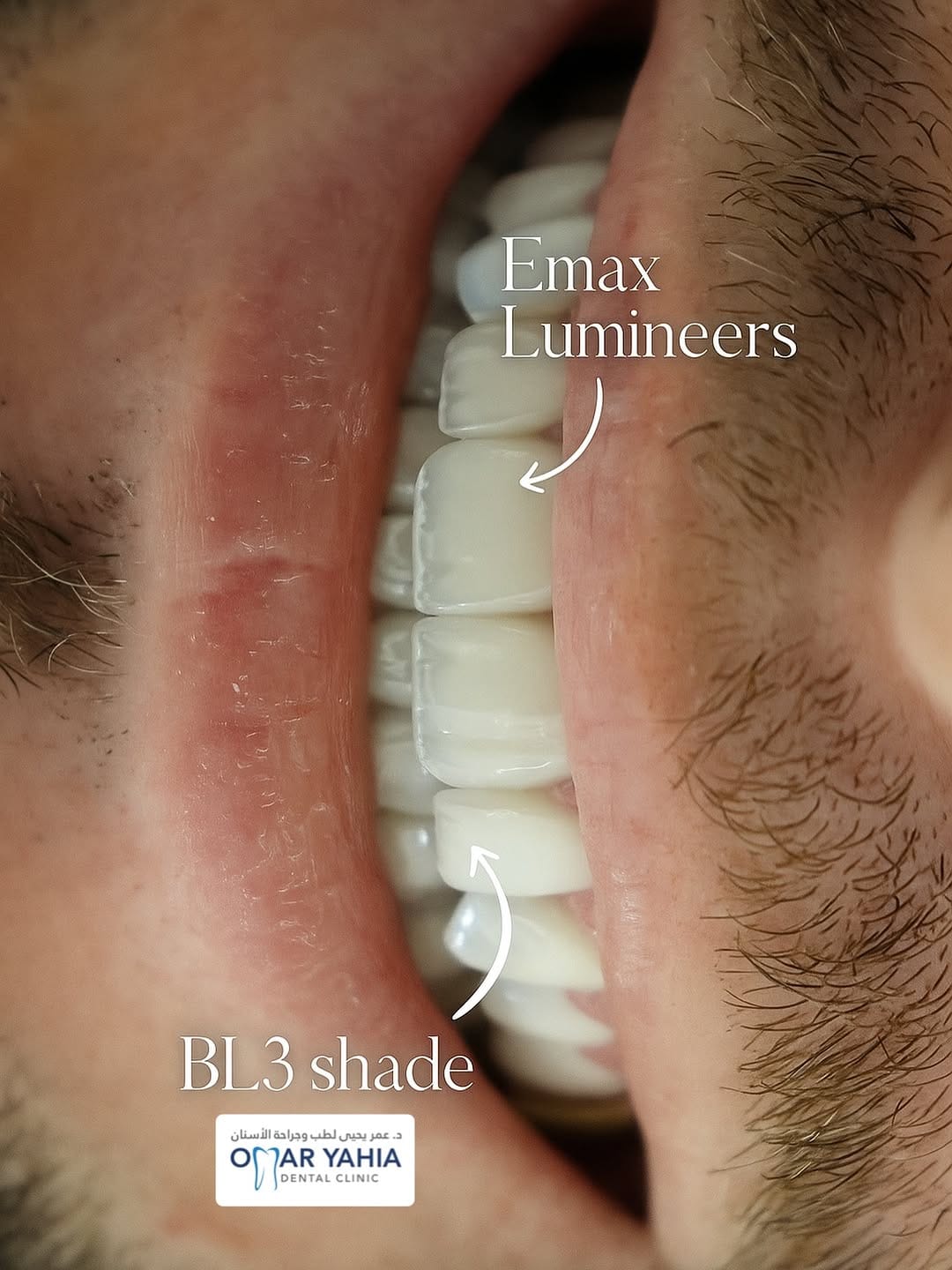 Post 8 by Omar Yahia Dental Clinic on Instagram (image)