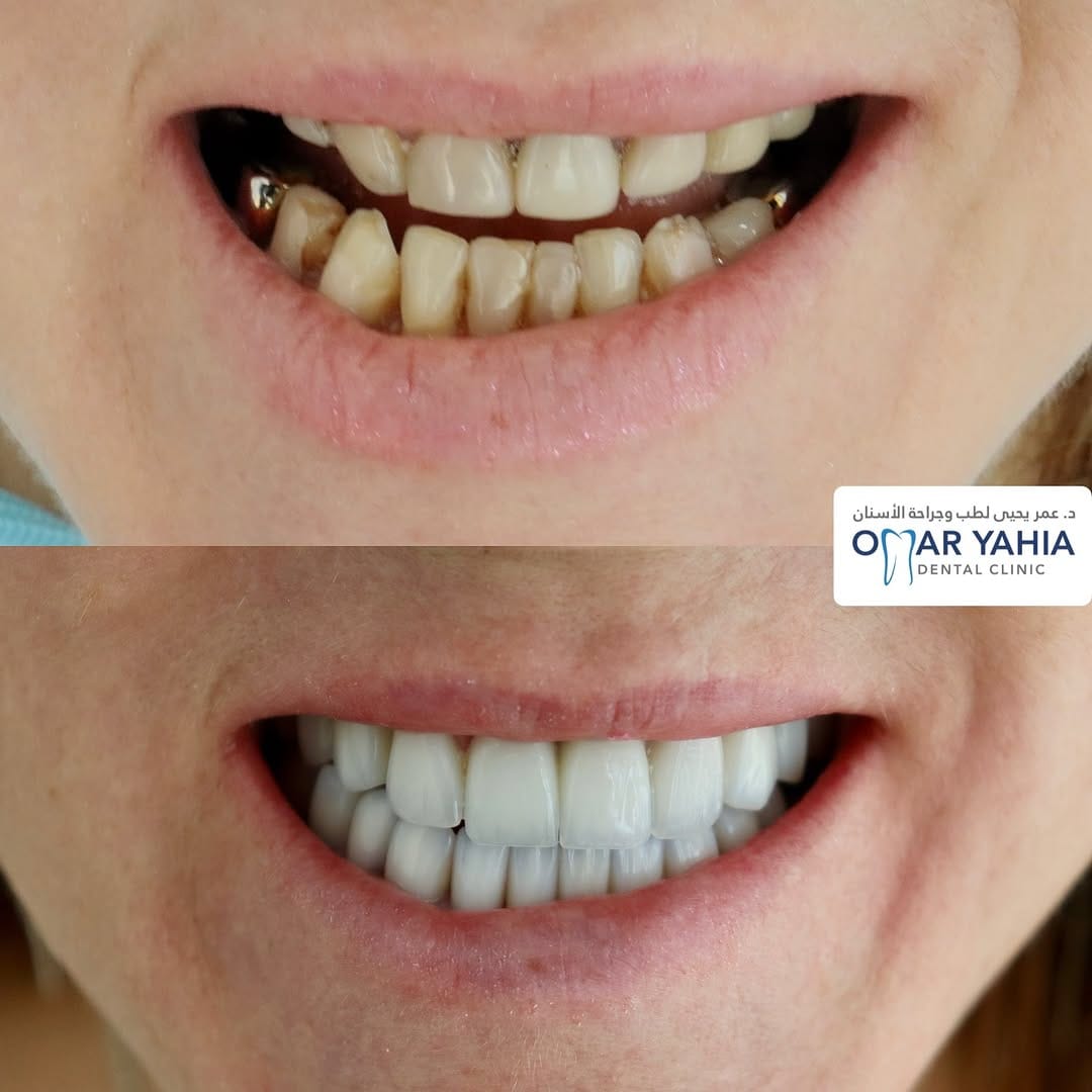 Post 6 by Omar Yahia Dental Clinic on Instagram (image)