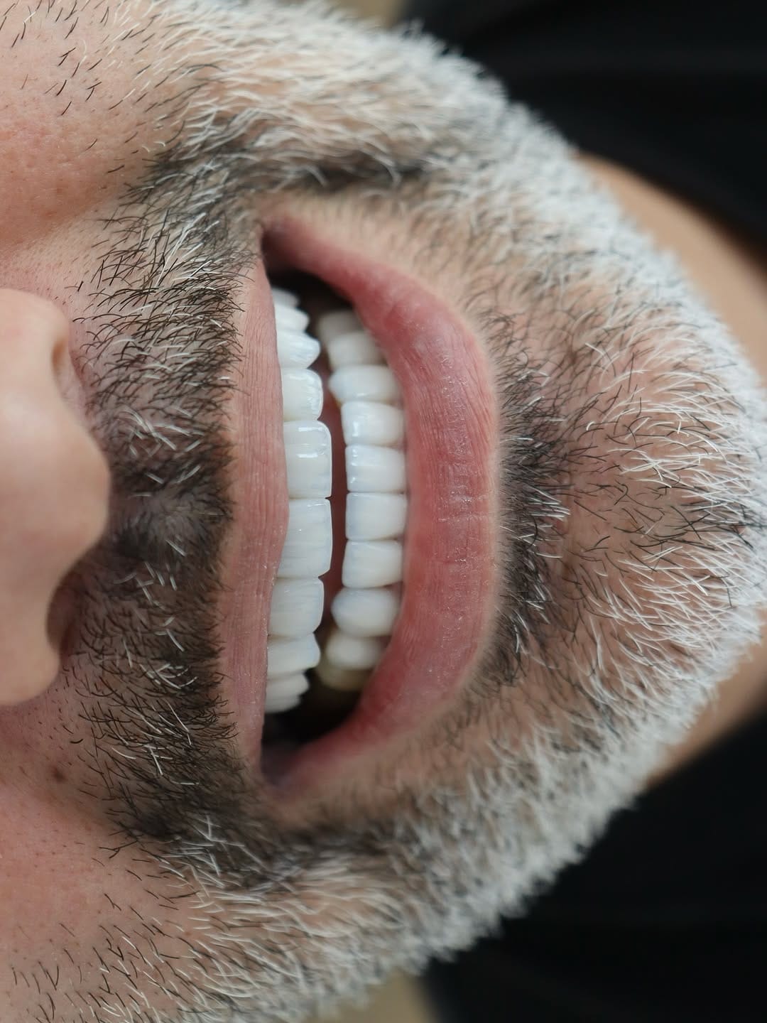 Post 2 by Omar Yahia Dental Clinic on Instagram (image)