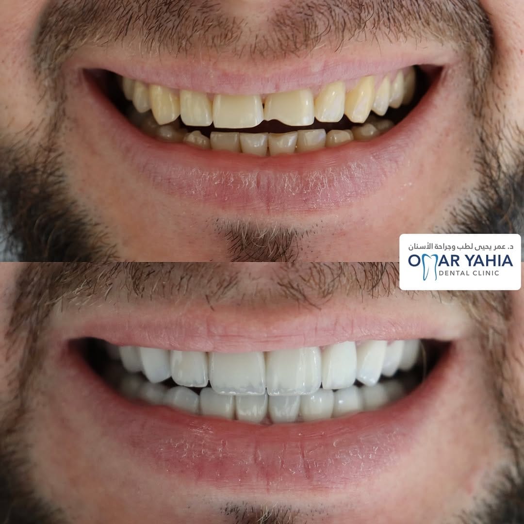 Post 9 by Omar Yahia Dental Clinic on Instagram (image)