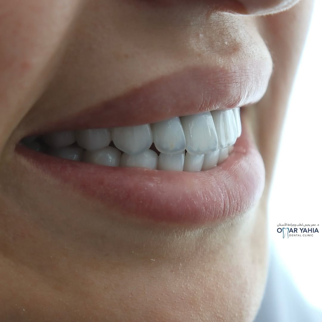 Post 10 by Omar Yahia Dental Clinic on Instagram (image)