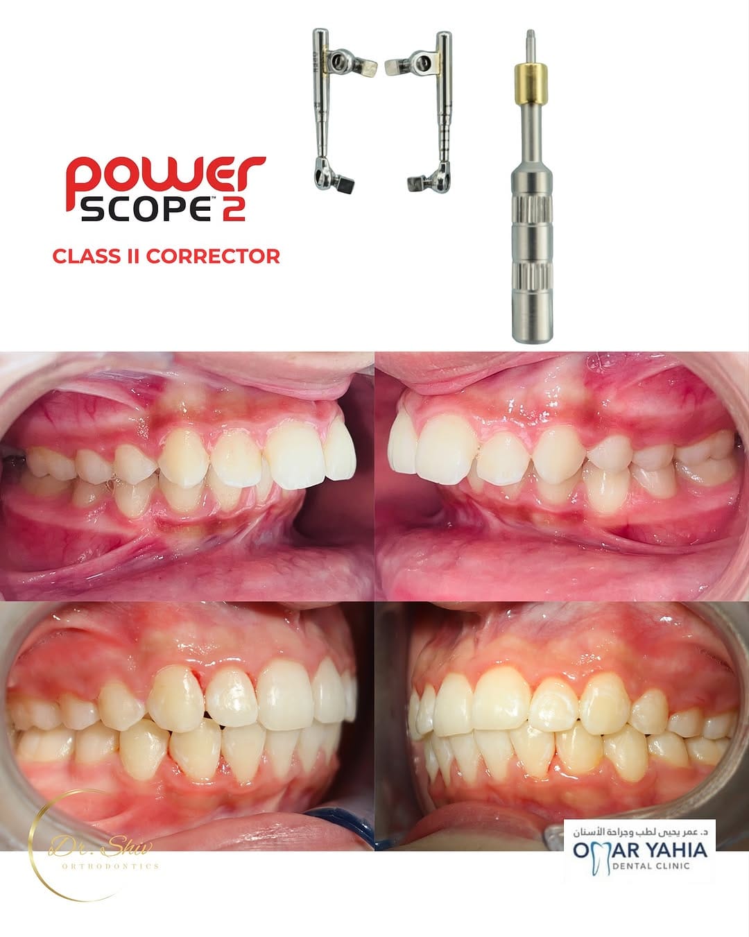 Post 5 by Omar Yahia Dental Clinic on Instagram (carousel)