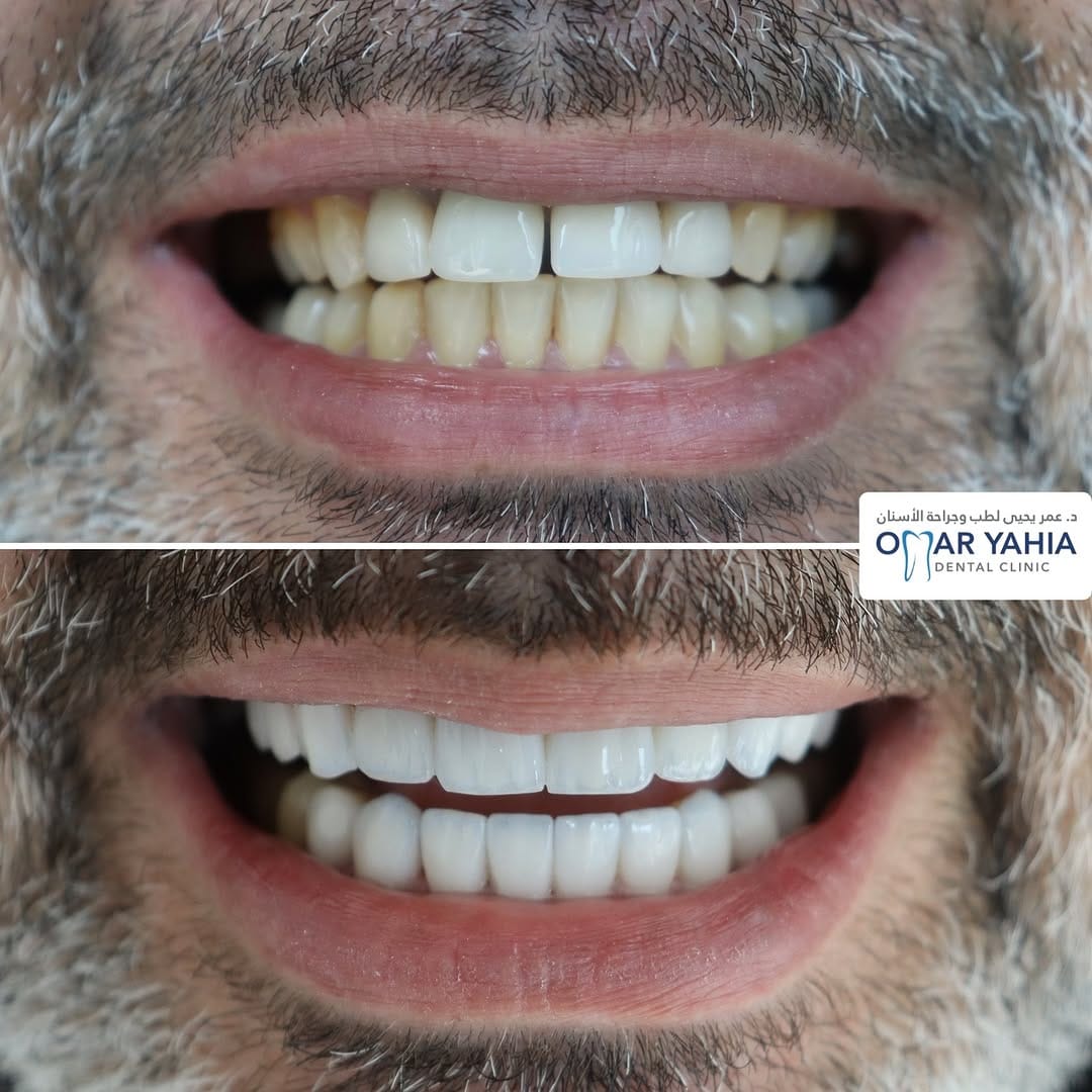 Post 3 by Omar Yahia Dental Clinic on Instagram (image)
