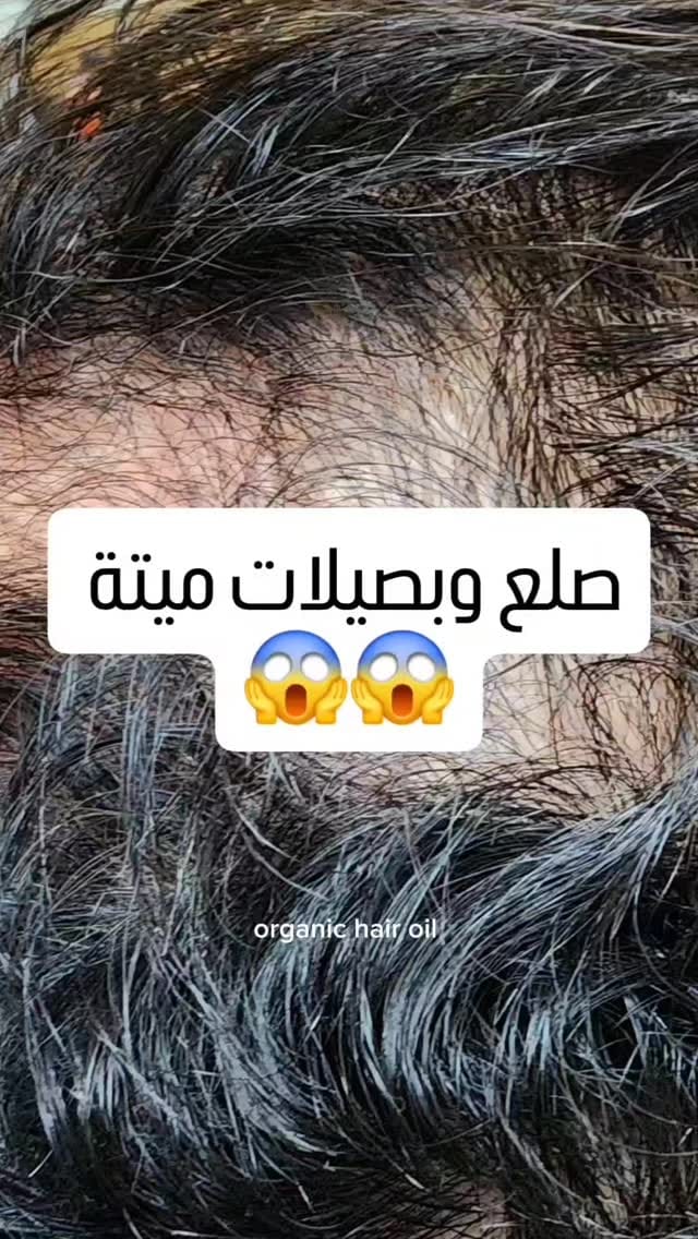 Post 8 by 🌿 زيوت معصورة ع البارد - سدر - حنة🌿 on Instagram (video)