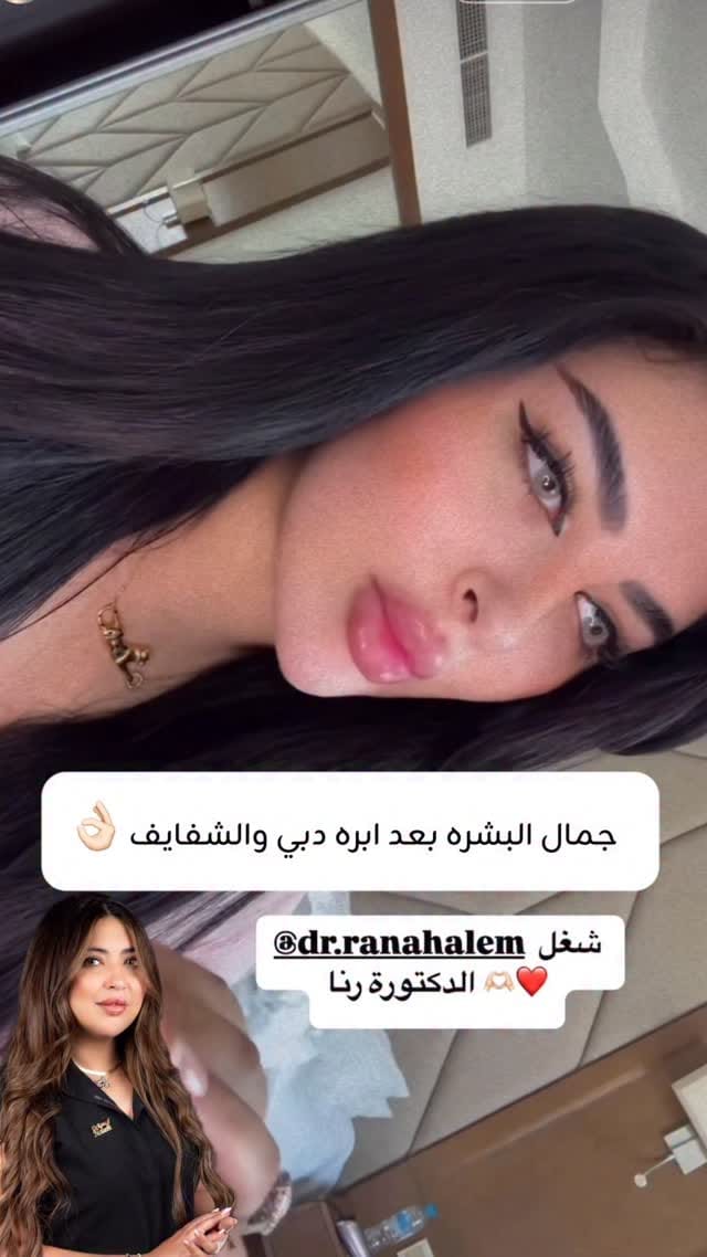 Post 8 by Dr.RanaHaleem 🇪🇬🇦🇪 on Instagram (video)