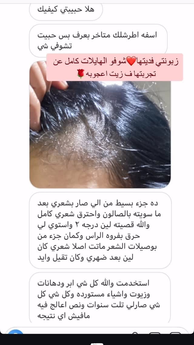Post 4 by زيت أعجوبة للشعر on Instagram (video)