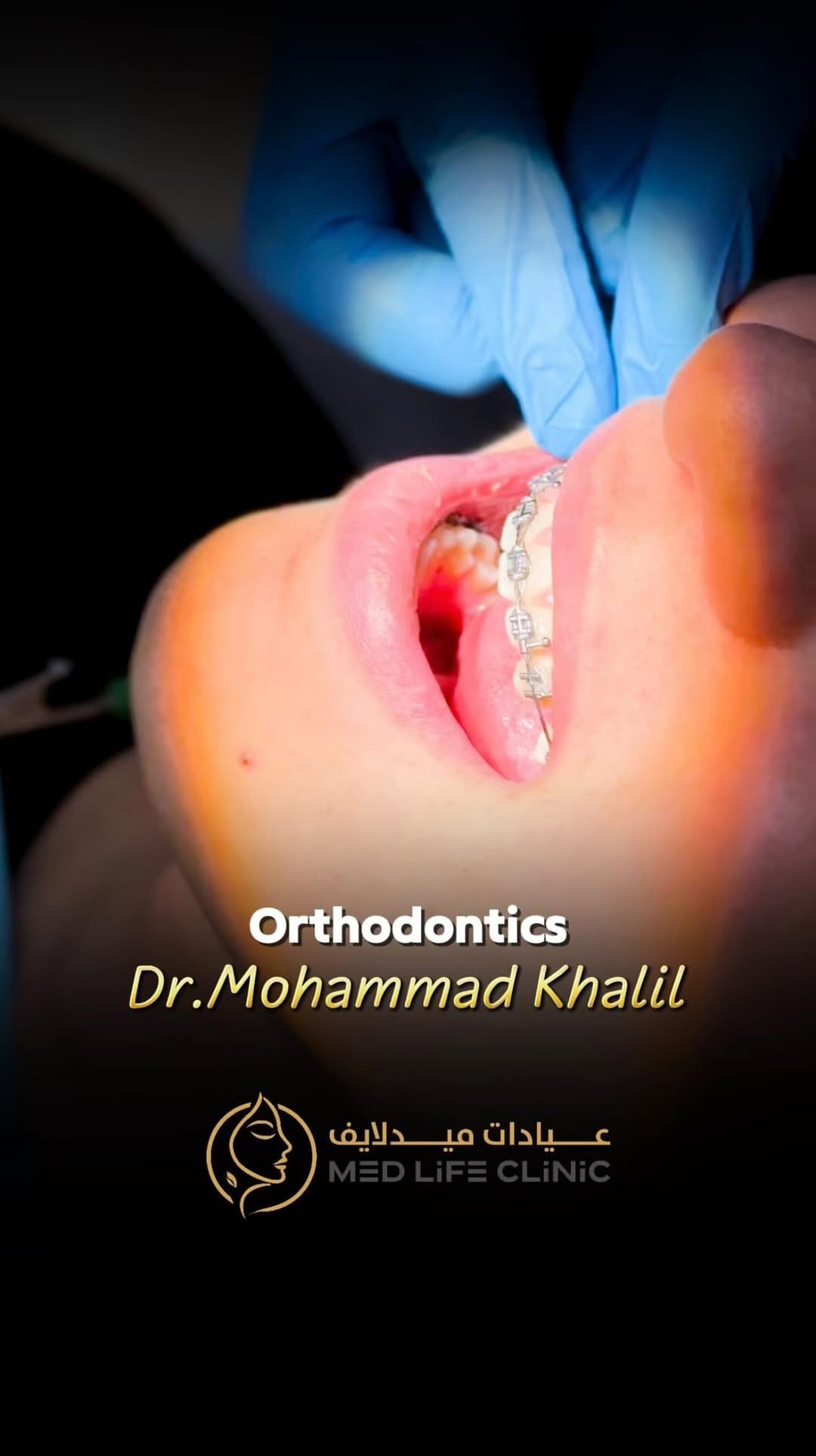 Post 7 by Medlife medical centre on Instagram (video)