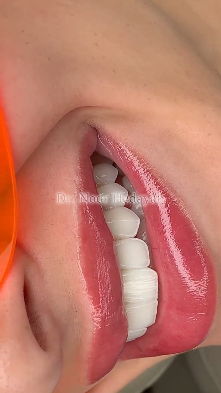 Post 2 by DR. NOOR HEDAYAH on Instagram (video)