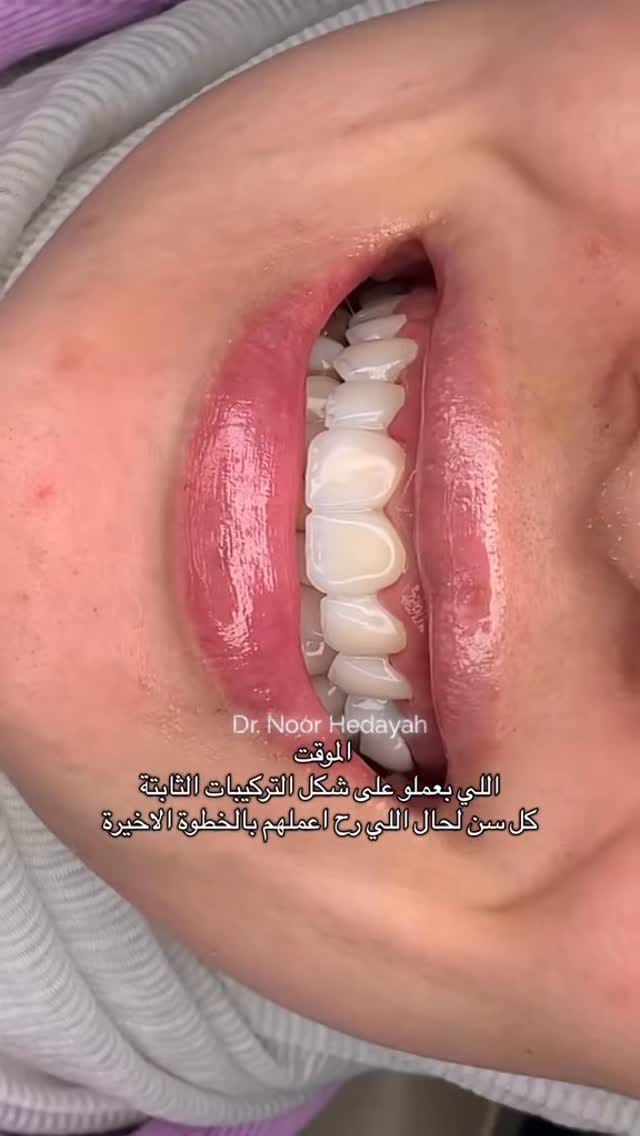 Post 8 by DR. NOOR HEDAYAH on Instagram (video)