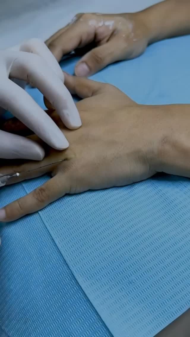 Post 3 by Dr Saman Zeeshan | Aesthetic Dermatology Dubai on Instagram (video)