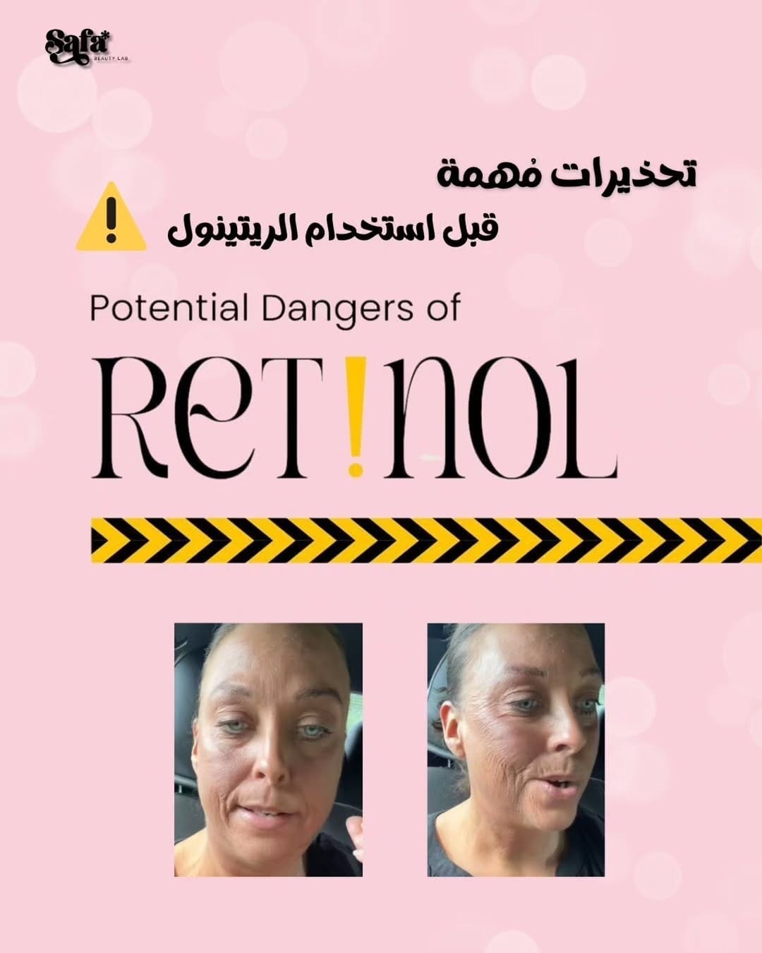 Post 2 by Safa Beauty Lab on Instagram (carousel)