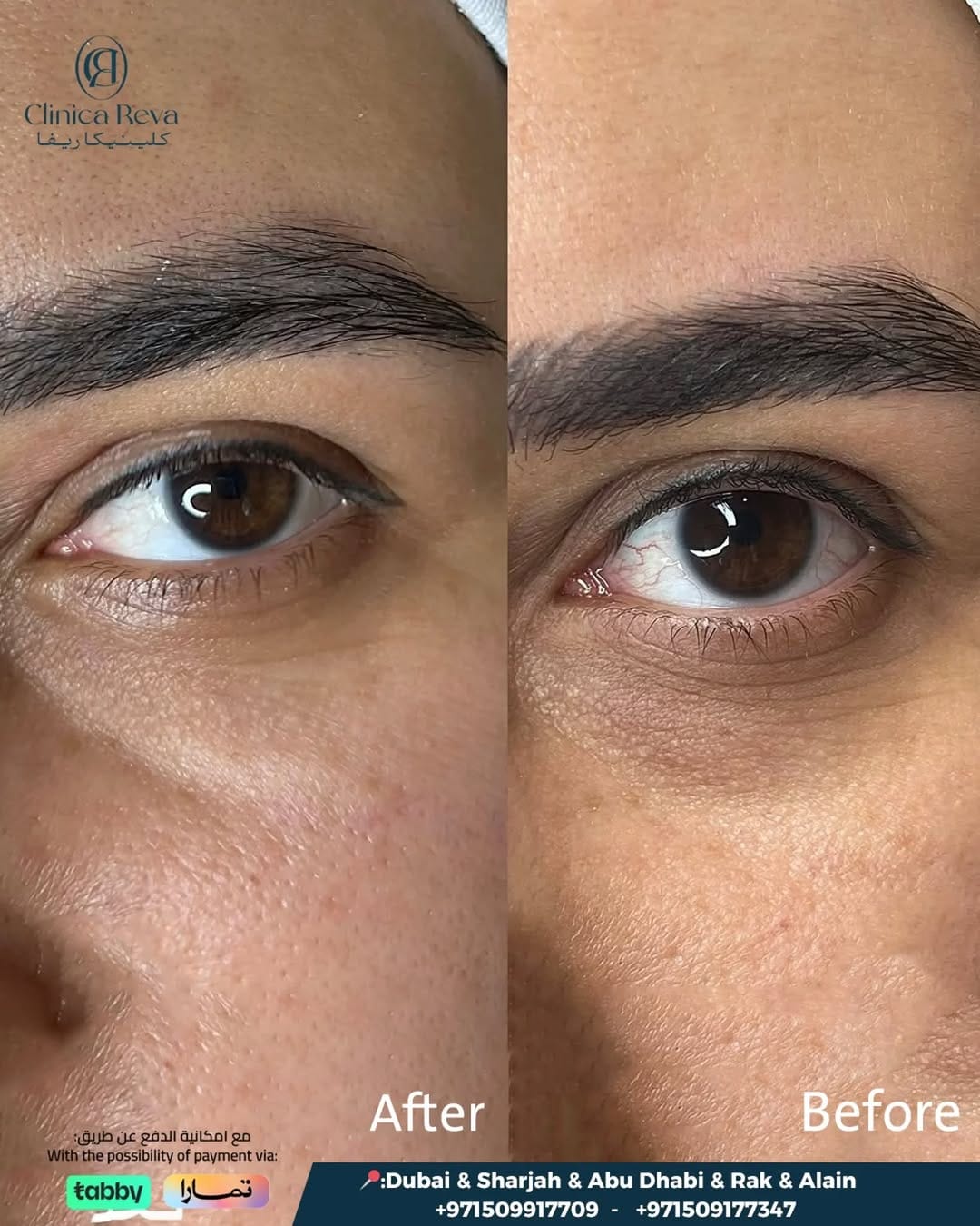 Post 5 by Clinica Reva on Instagram (image)