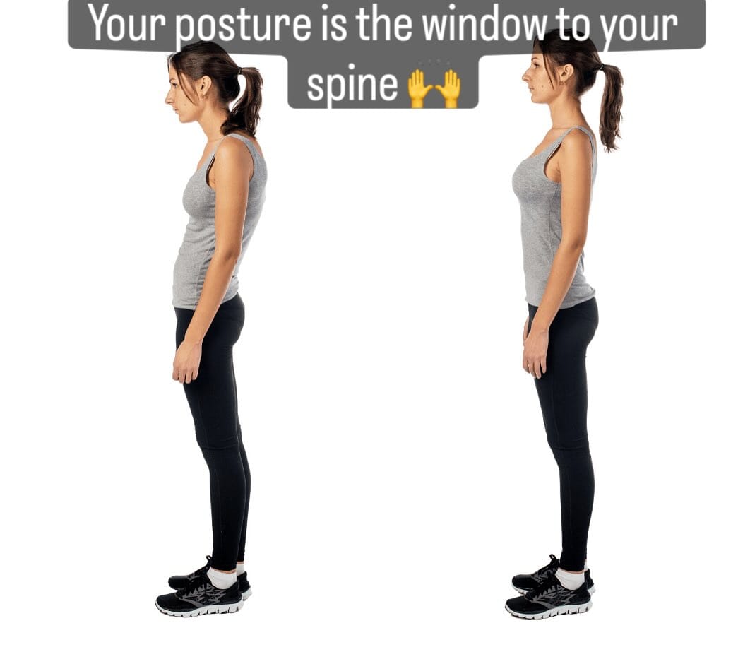 Post 3 by Dr Adil Karmali D.C. | Wellness Expert | Posture Correction on Instagram (image)