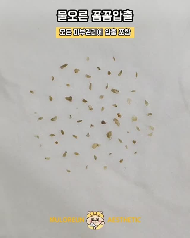 Post 5 by 대구웨딩케어 대구신부관리 대구피부관리 월성동에스테틱 대구윤곽관리 대구문제성피부 물오른피부 on Instagram (video)