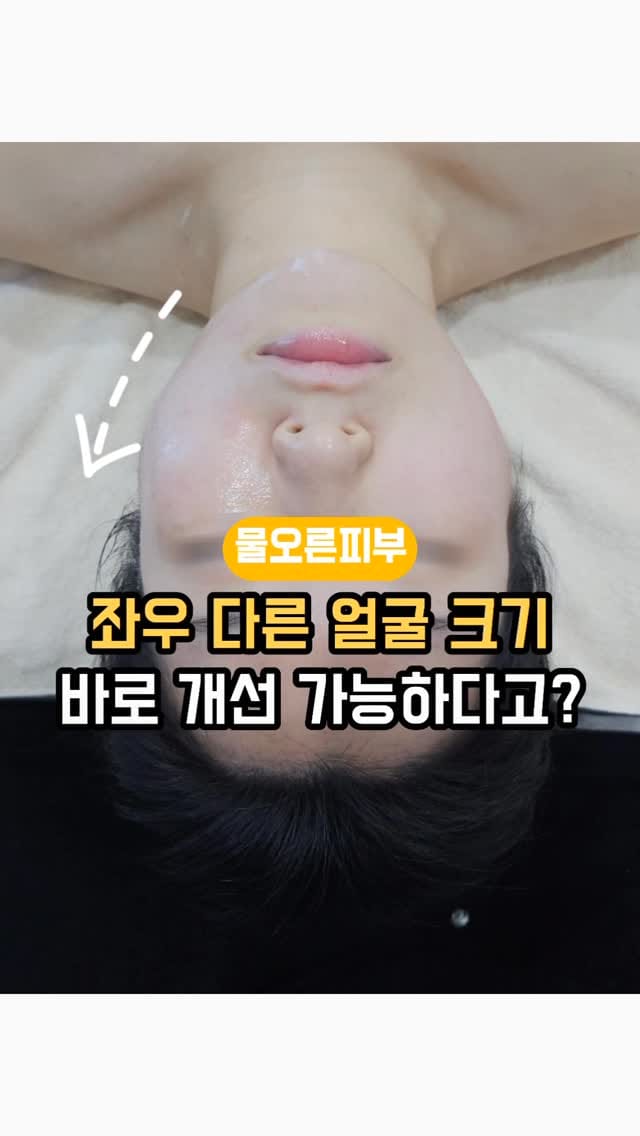 Post 6 by 대구웨딩케어 대구신부관리 대구피부관리 월성동에스테틱 대구윤곽관리 대구문제성피부 물오른피부 on Instagram (video)