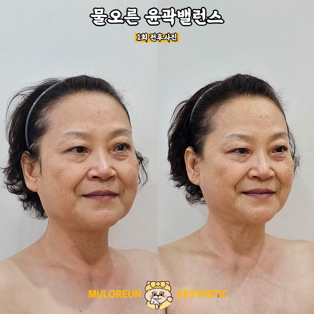 Post 10 by 대구웨딩케어 대구신부관리 대구피부관리 월성동에스테틱 대구윤곽관리 대구문제성피부 물오른피부 on Instagram (image)