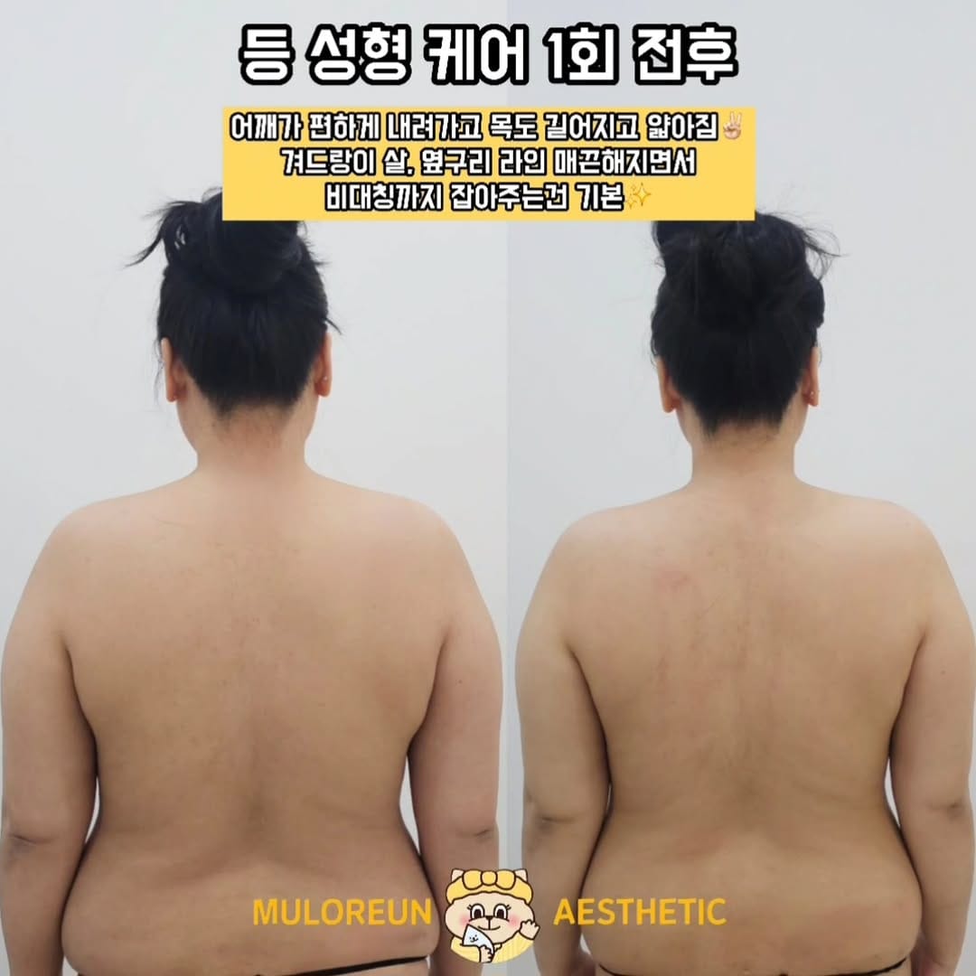 Post 1 by 대구웨딩케어 대구신부관리 대구피부관리 월성동에스테틱 대구윤곽관리 대구문제성피부 물오른피부 on Instagram (image)