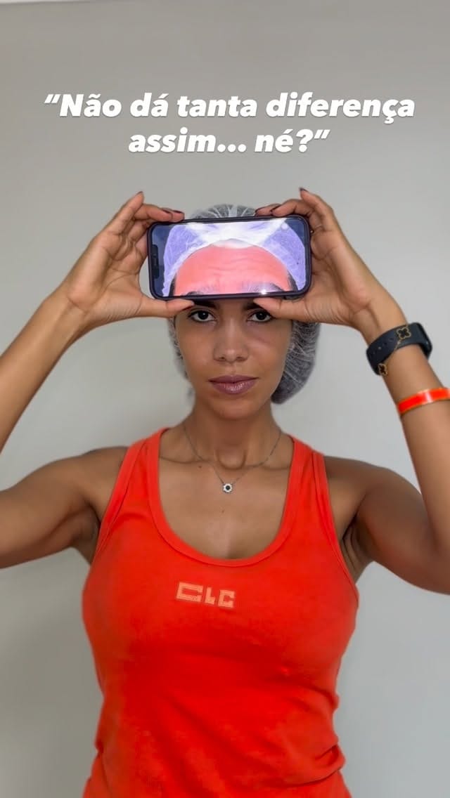 Post 2 by Dra.Patricia Santhiago | Enfermeira Esteta on Instagram (video)