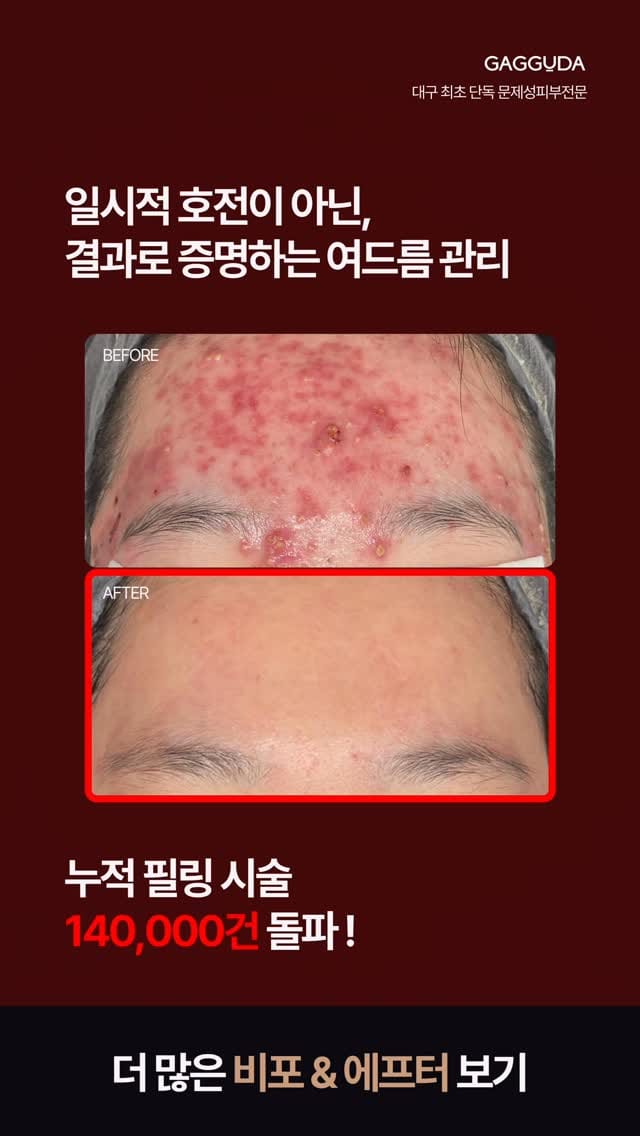 Post 5 by 대구피부관리 가꾸다 대표원장 신서은 on Instagram (video)