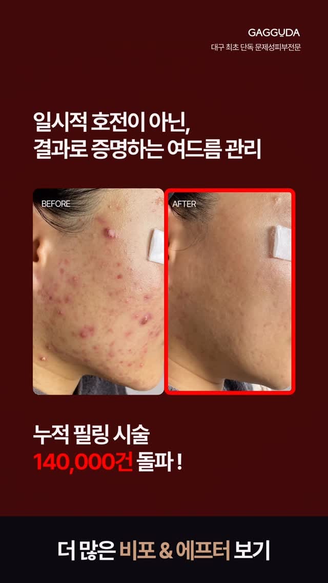 Post 6 by 대구피부관리 가꾸다 대표원장 신서은 on Instagram (video)