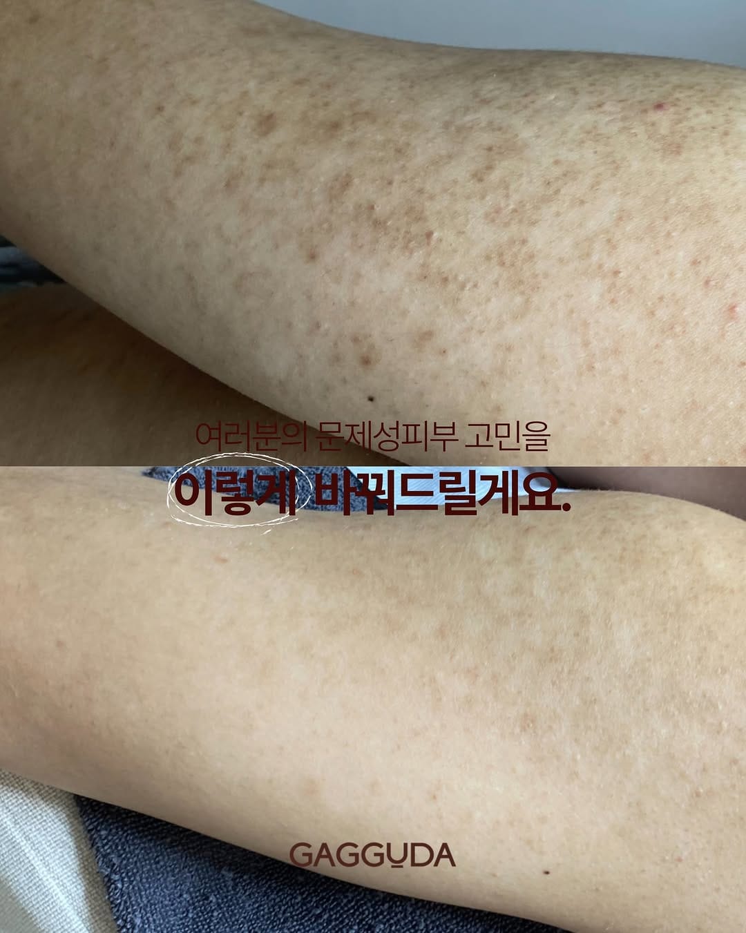 Post 7 by 대구피부관리 가꾸다 대표원장 신서은 on Instagram (carousel)