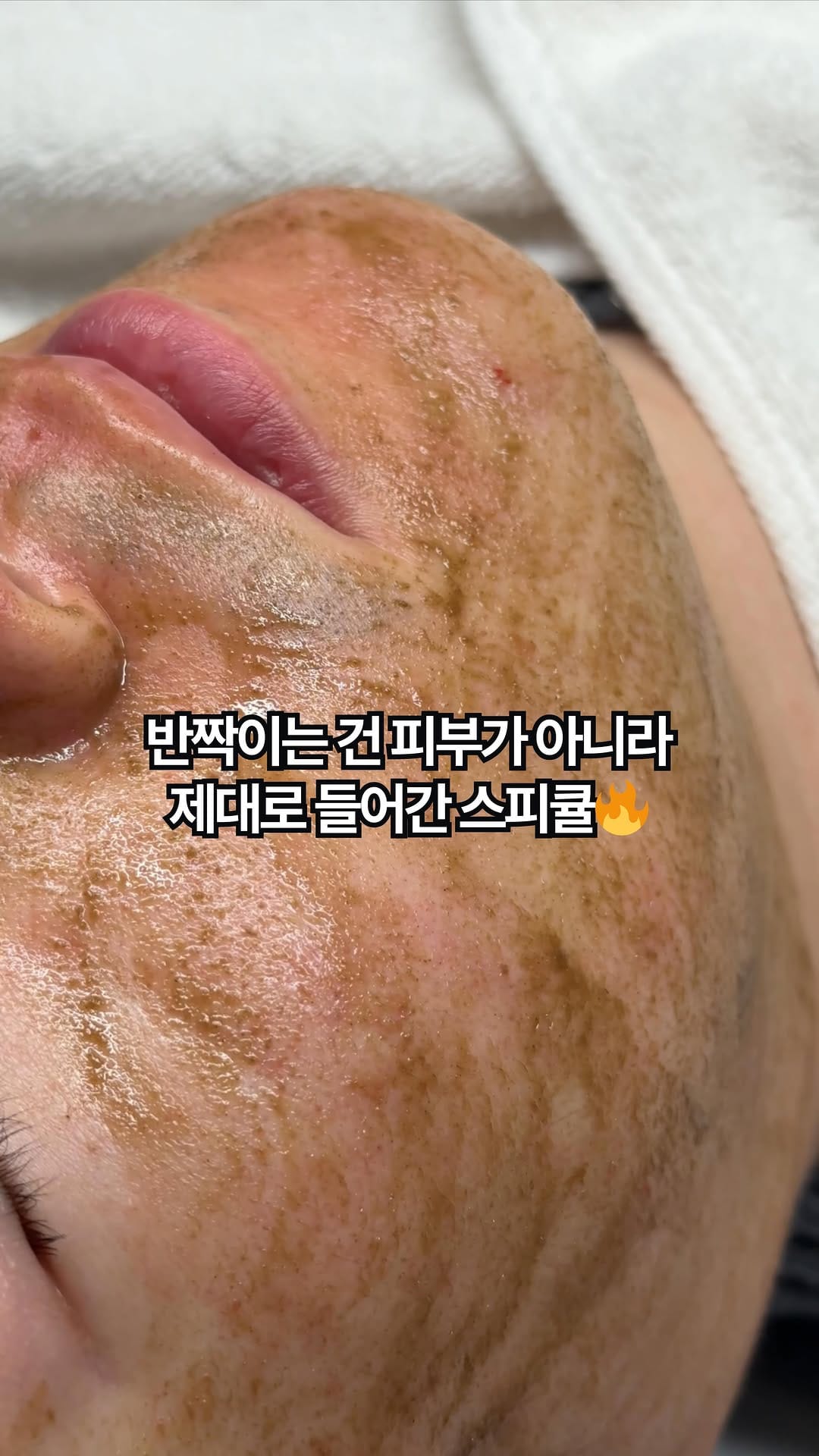 Post 8 by 대구피부관리 가꾸다 대표원장 신서은 on Instagram (video)
