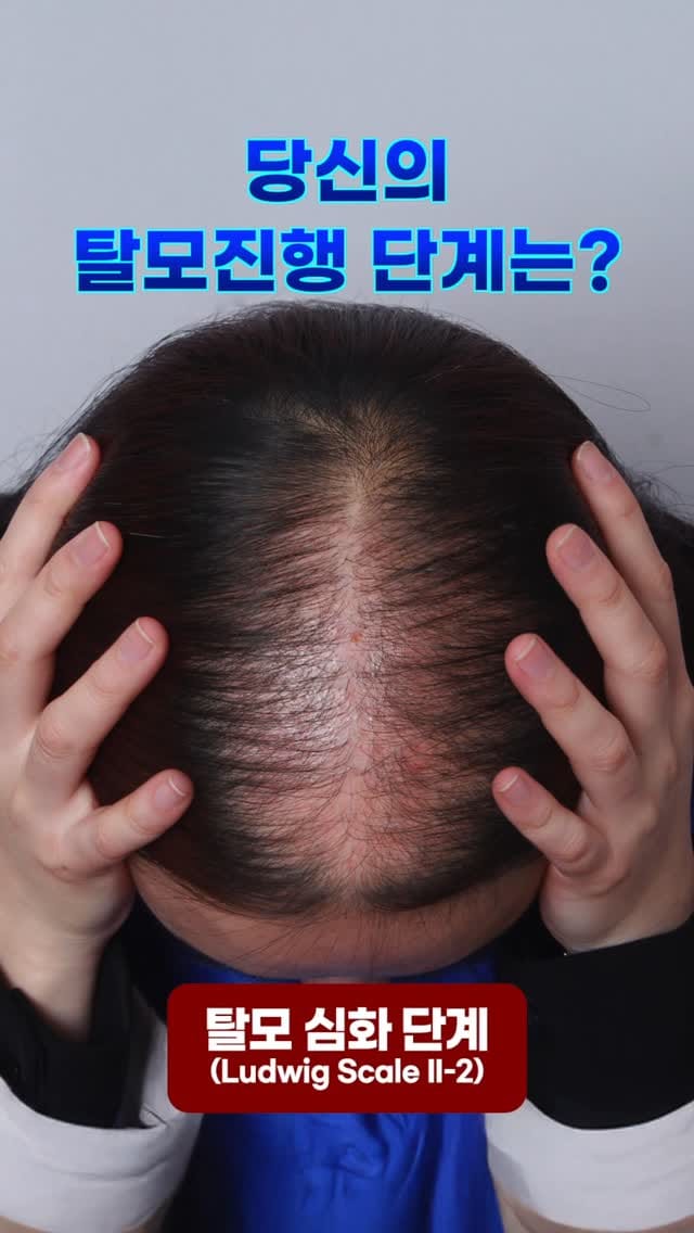 Post 1 by 맥스웰피부과 on Instagram (video)