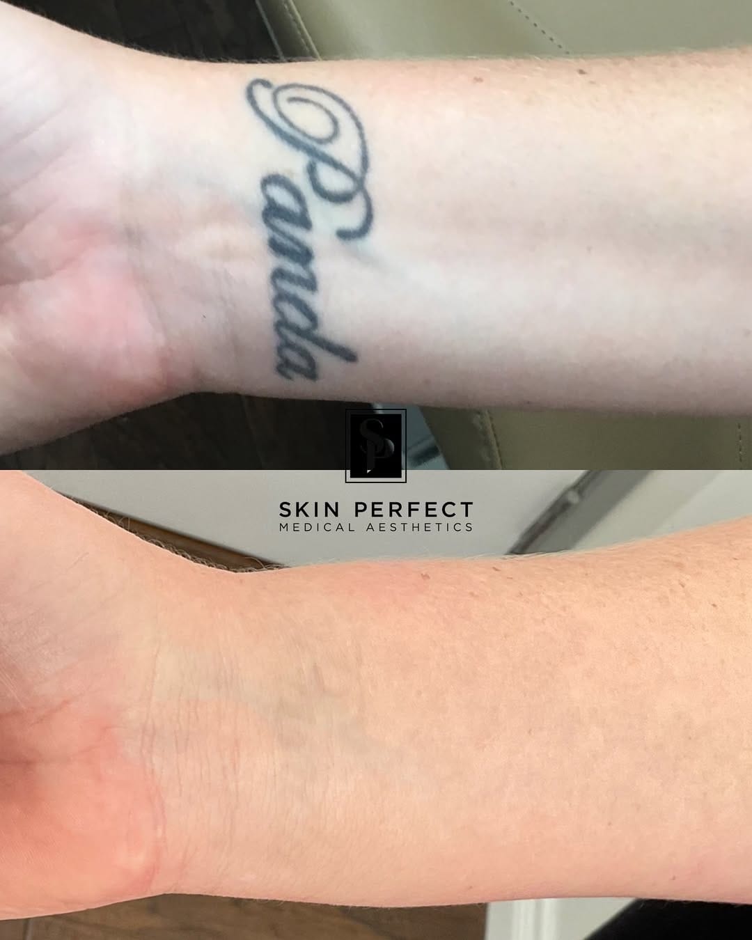 Post 7 by Skin Perfect Rancho Cucamonga on Instagram (carousel)