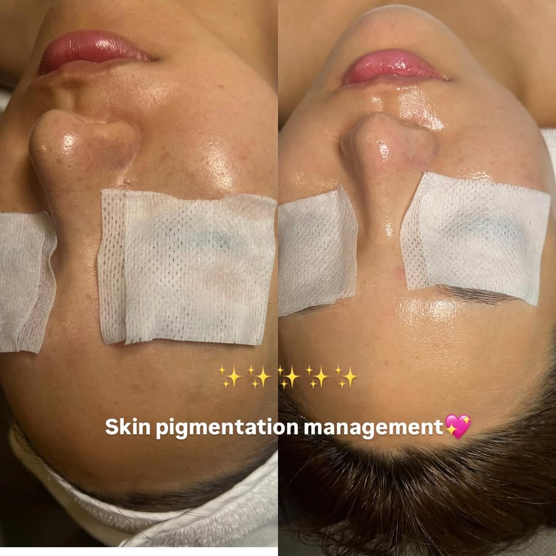 Post 2 by K-beauty on Instagram (image)