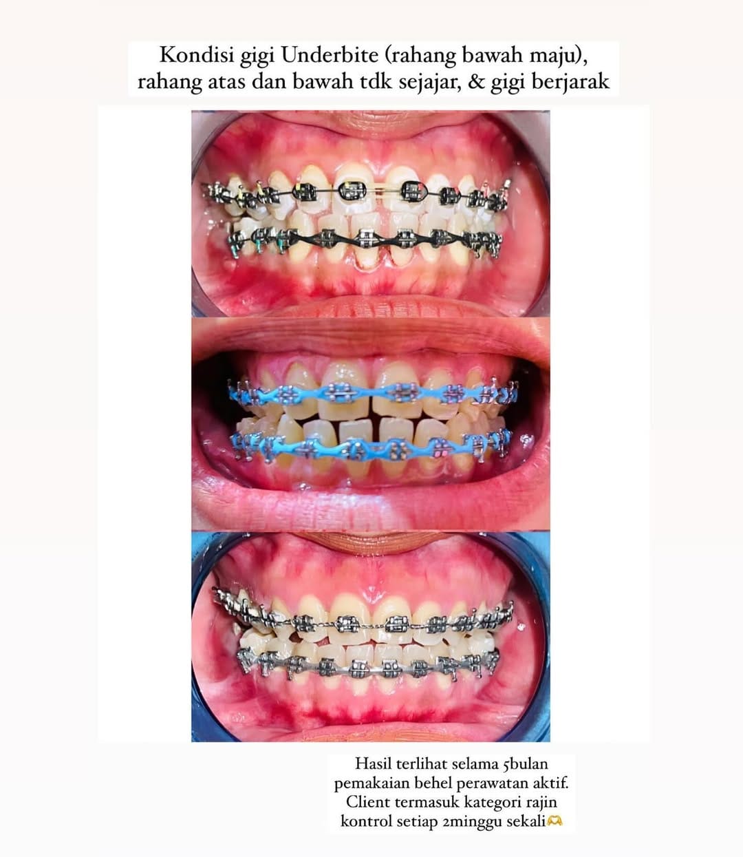 Post 9 by Studio Behel Perawatan Aktif & Fashion on Instagram (image)