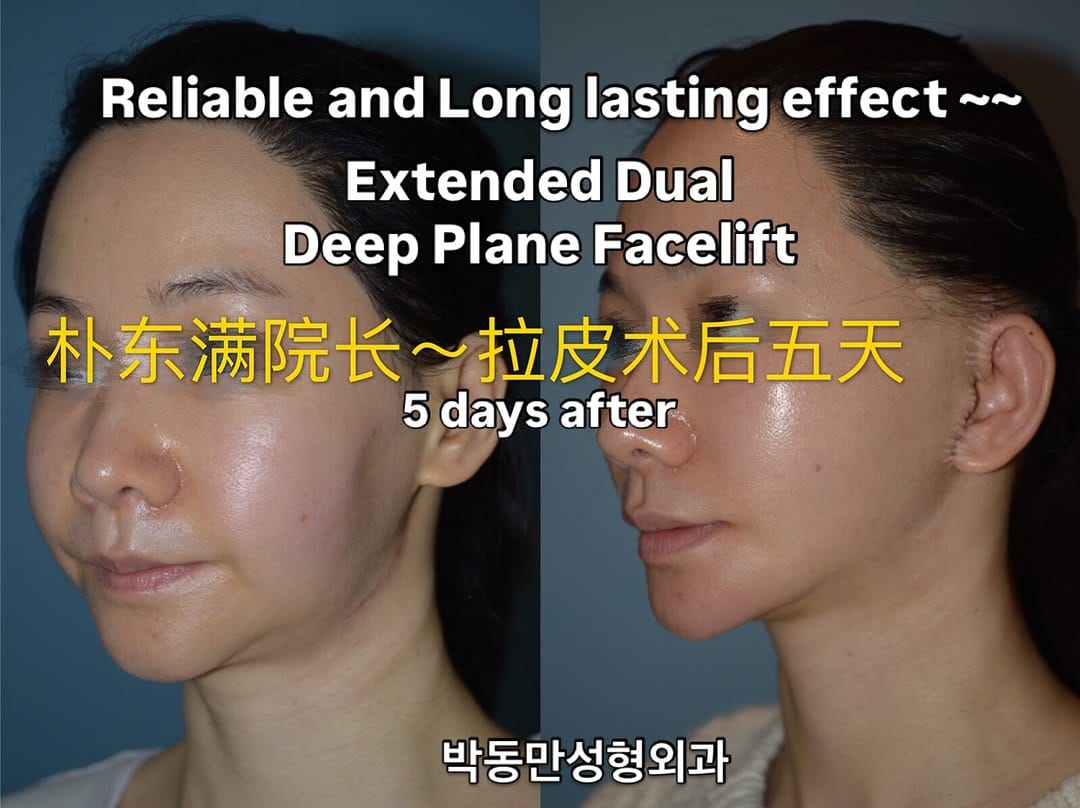 Post 1 by PDM Plastic Surgery Clinic on Instagram (image)