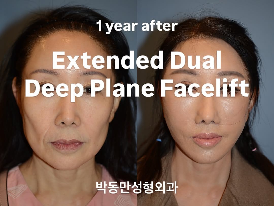 Post 8 by PDM Plastic Surgery Clinic on Instagram (image)