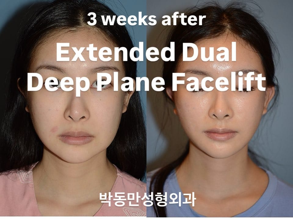 Post 9 by PDM Plastic Surgery Clinic on Instagram (image)