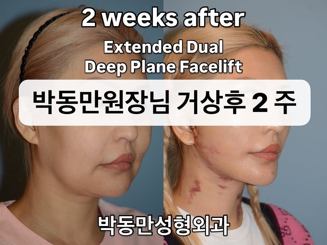 Post 2 by PDM Plastic Surgery Clinic on Instagram (image)